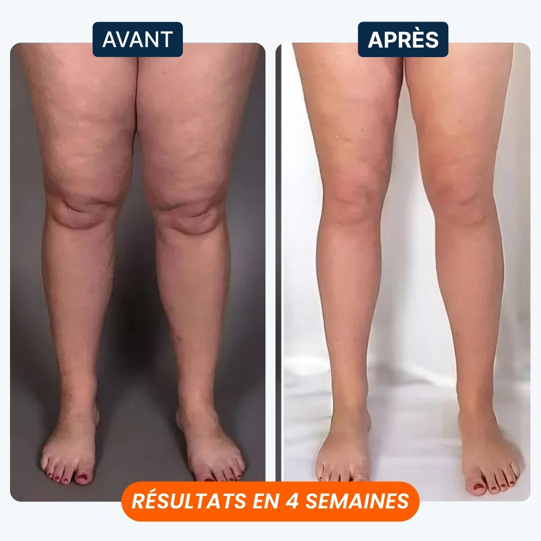 PulSave® - Votre Allié Anti Jambes Lourdes